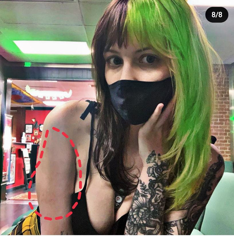turtlelip's tweet photo. #Taylornicoledean must be spun out of her mind to think we can't see where she blurred out the track marks https://t.co/7GJYZZdVAw