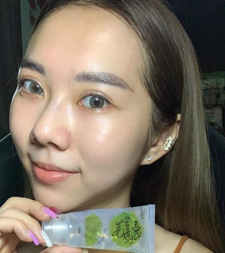 ChashoppN's tweet photo. เจลใสๆ แต่ใช้โครตดี 9 9 บๅทเอง🥒💚

ุขนาด 42ml. หลอดละ 99 บาท🌻
โปร 3 หลอด 299 ฉ่งฟรี💯
.
.
สนใจ : ติดต่อ/สั่งซื้อ
Line : natcha110243
.
.
#เจลซ่อมผิว #เจลหน้าใส #หน้าใสไร้สิว #ลดสิว #เจลซ่อมผิว #รับตัวแทนจำหน่ายทั่วประเทศ #เรทแซ่บ #ขายง่ายขำไรดี #ครีมไวท์สมูท #ไวท์สมูท https://t.co/4rvZMGvkdD