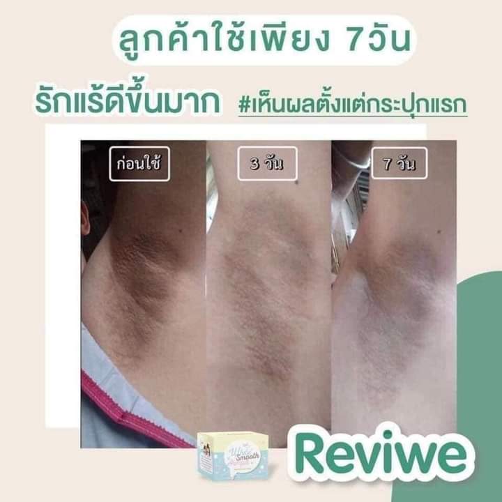 ChashoppN's tweet photo. รักแร้เนียนขาว ไว้ใจไวท์สมูทได้เลย💚

ขนาด10g. 150฿ 
แถมฟรี รักแร้ขาว ✨ 

❌งดใช้ร่วมกับโรออน❌

#ไร้รีวิวห้ามขายของโว้ย #รับตัวแทนจำหน่าย #เรทแซ่บ
 #ครีมไวท์สมูท #ไวท์สมูท #betawhitesmooth #whitesooth #ครีมรักแร้ขาว #ครีมตัวขาว #รัก��ร้ขาว #ครีมสดสิว #ผิวขาว #ครีมหน้าใส https://t.co/5zetnxnrj1
