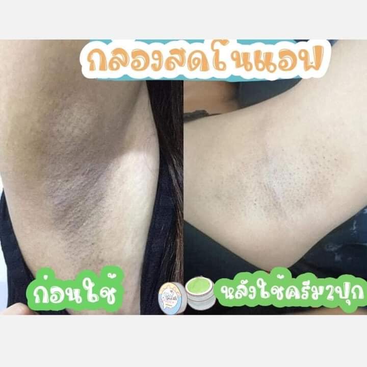 ChashoppN's tweet photo. รักแร้เนียนขาว ไว้ใจไวท์สมูทได้เลย💚

ขนาด10g. 150฿ 
แถมฟรี รักแร้ขาว ✨ 

❌งดใช้ร่วมกับโรออน❌

#ไร้รีวิวห้ามขายของโว้ย #รับตัวแทนจำหน่าย #เรทแซ่บ
 #ครีมไวท์สมูท #ไวท์สมูท #betawhitesmooth #whitesooth #ครีมรักแร้ขาว #ครีมตัวขาว #รัก��ร้ขาว #ครีมสดสิว #ผิวขาว #ครีมหน้าใส https://t.co/5zetnxnrj1