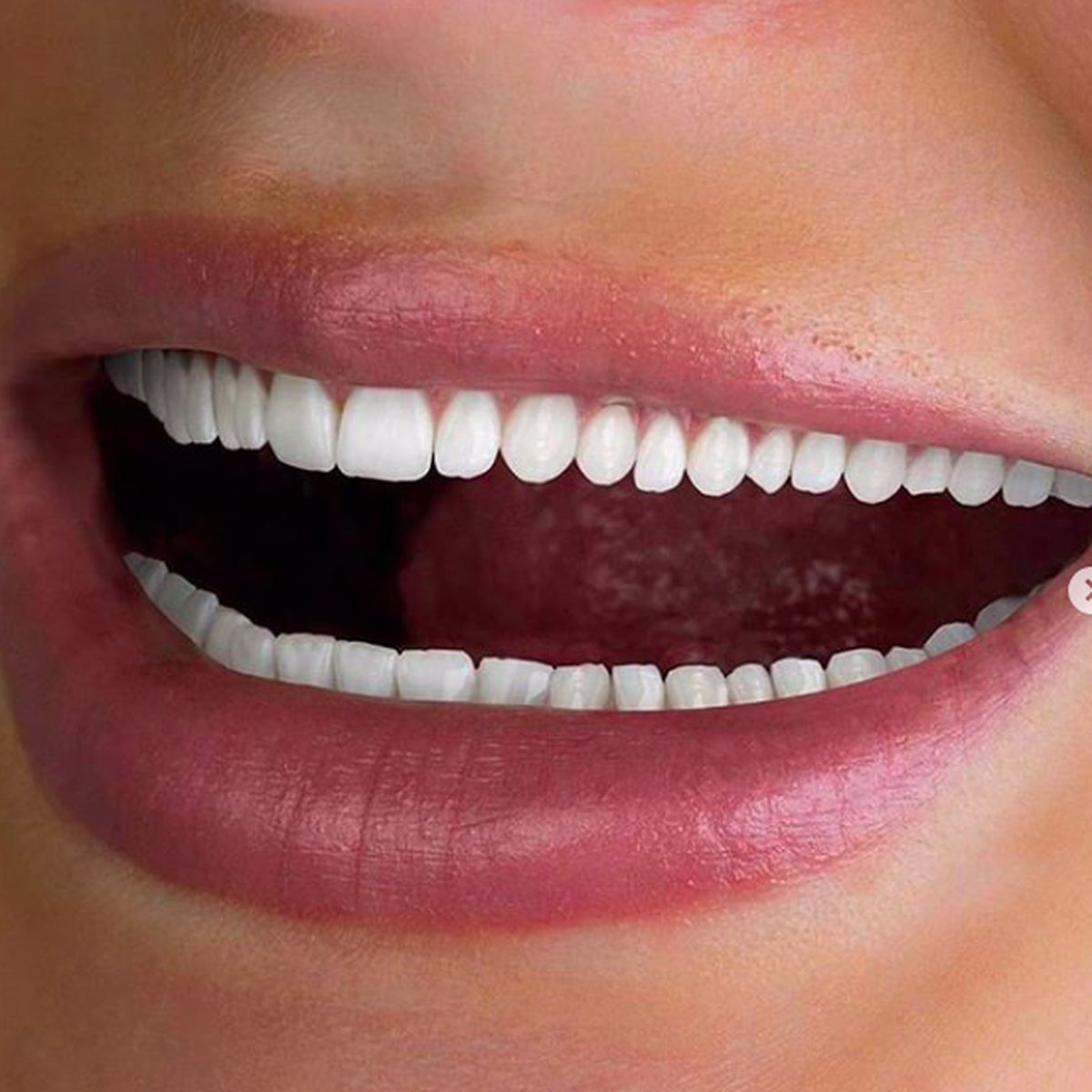 dentist4corpse's tweet photo. @emms_alt u haven't seen the half of it https://t.co/fyPhAO1d8J