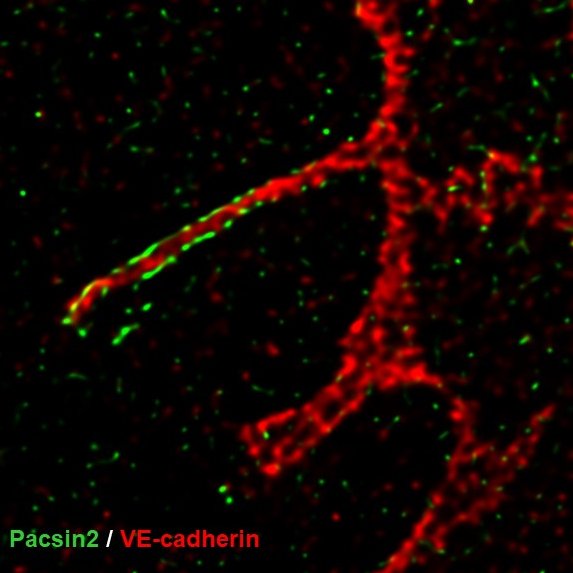 Huveneers_Lab's tweet photo. Did you know that homotypic AJs can adopt front-rear polarized conformations? Asymmetric junctions are so cool!
#cellbio2020 Minisymp 27: Pushing and Pulling Within and Between Cells
#junctions #angiogenesis #collectivemigration
5:30 PM - 7:00 PM CET on Friday, December 11 https://t.co/vrXrjIgjUg