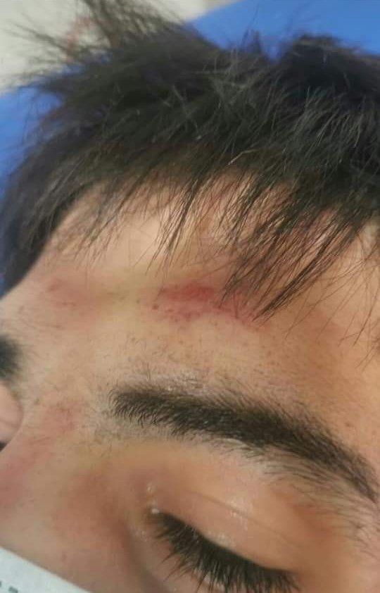 msslibra13's tweet photo. 👇👇👇Agresión de inmigrantes a canario por defender a una chica a la que acosaban #GRANCANARIA ANFI DEL MAR https://t.co/1vLB0vhLbE