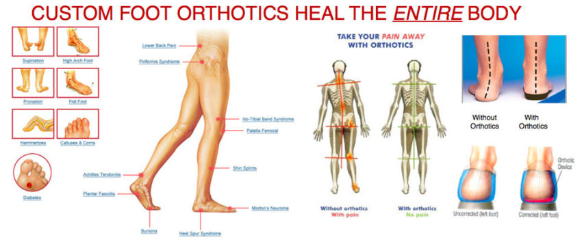 Having a correct alignment important not only for your feet but for your entire body!
Orthotics are the best way for anyone to naturally improve the alignment through your body.