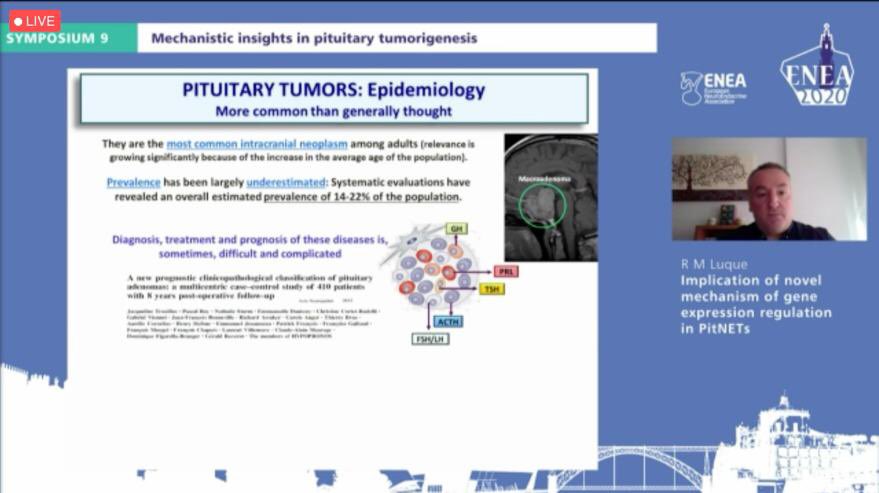 OncMet27's tweet photo. It’s time for our PI to present new data on the implication of novel mechanisms of gene expression regulation in PitNETs during #enea2020 @ENEAssoc @ENEA_Young
🔝🔝🔝🔝👏🏼👏🏼👏🏼👏🏼 https://t.co/3wwg2GQxN7