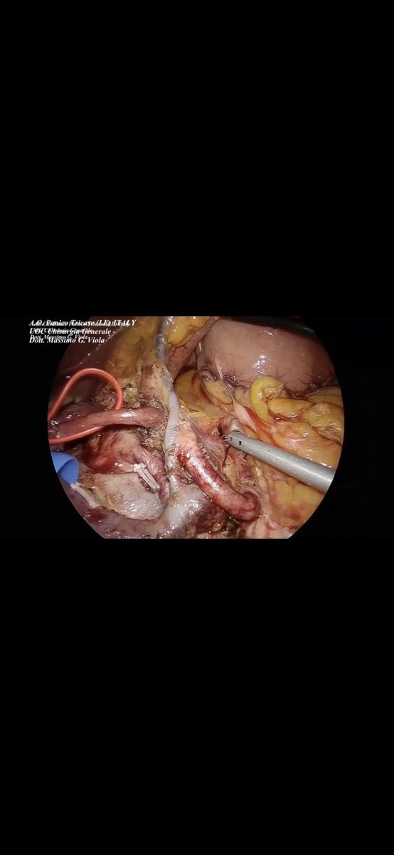 Hbp_EgLleida's tweet photo. Attending the @IHPBA 2020 online congress: learning from the best to keep growing
Team: @JjOlsina @AlfredoEscartin @JimyJara @ffrank_vp @martagodu @HelenaSalvadorR @pmuriel_al 
@EAHPBA @EAES_eu @seccionhbpaec @HpbMar @MIAGB2 @CEIHPBA https://t.co/SGkUBqf6JE