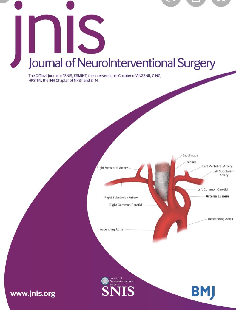 dockhandelwal's tweet photo. All credit to @patelnv and @NeilMajMD for this JNIS cover ! @svinsociety @RUNeurosurgery  @PratitDPatel @RutgersNeuroDoc @JNIS_BMJ @SNISinfo . https://t.co/qZtsQntL2y