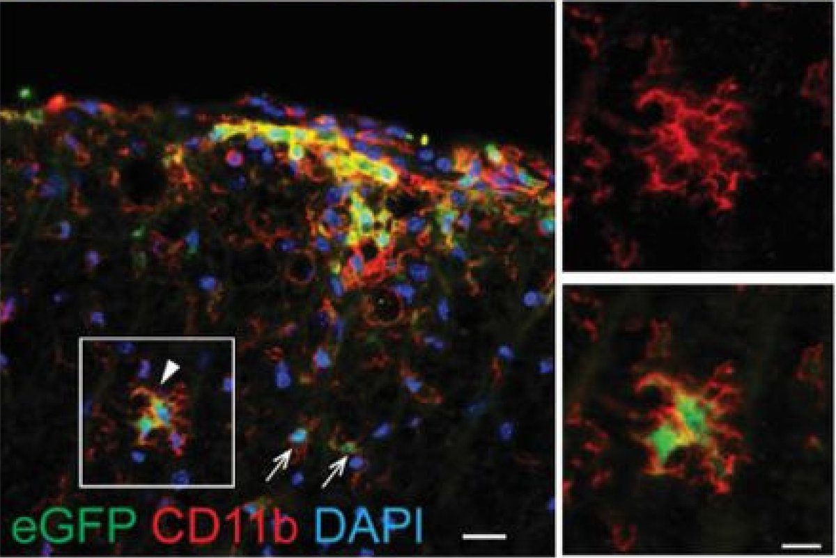 fmayrhofer's tweet photo. Reduction in CD11c+ microglia promotes clinical progression in autoimmune demyelination

#ms #multiplesclerosis #neuroinflammation #microglia

https://t.co/1rWTh8DM5K https://t.co/GiRV8XAdV1