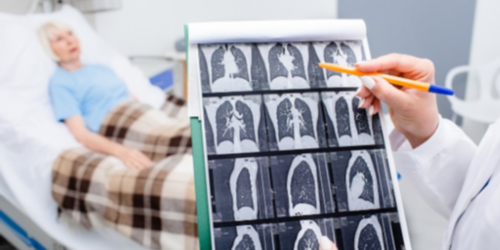 NH recently ranked 3rd nationally in high-risk lung cancer screening rates! This is great news to us at <a href="/SolutioNHlth/">SolutionHealth</a>. Both <a href="/ElliotHealthSys/">Elliot Health System</a> and <a href="/SNHHealth/">Southern NH Health</a> are committed to offering lung cancer screening.
Congratulations to everyone who helped improve NH's lung-screening rates!