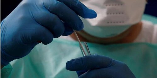 За добу в Україні – 9 946 нових випадків COVID-19 https://t.co/WoEQzePfwe
9 946 нових випадків коронавірусної хвороби COVID-19 зафіксовано в Україні станом на 30 листопада 2020 року. Зокрема, захворіли 570 дітей та 360 медпрацівників. Також за минулу добу: госпіталізовано ... https://t.co/GlXpFNkKkF