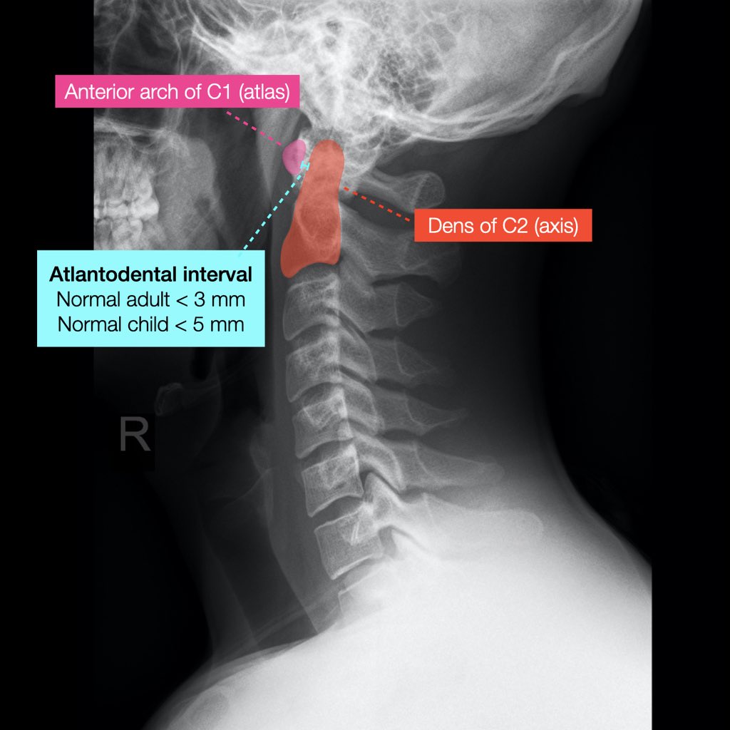 Radiopaedia tweet picture