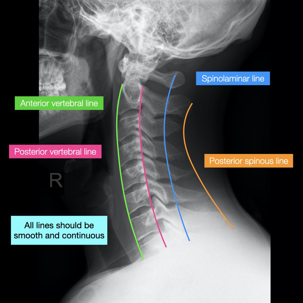 Radiopaedia tweet picture