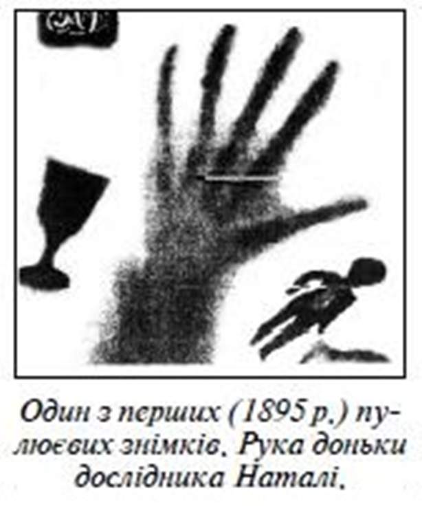 AlexanderDzyuba's tweet photo. @worldfirstthin It was invented, documented, and used in medical purposes by Ukrainian scientist Ivan Puliuy 14 years before Roethen. https://t.co/8OCVHKEH3t