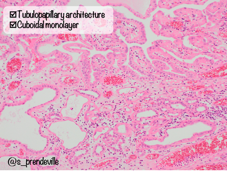 Susan Prendeville tweet media