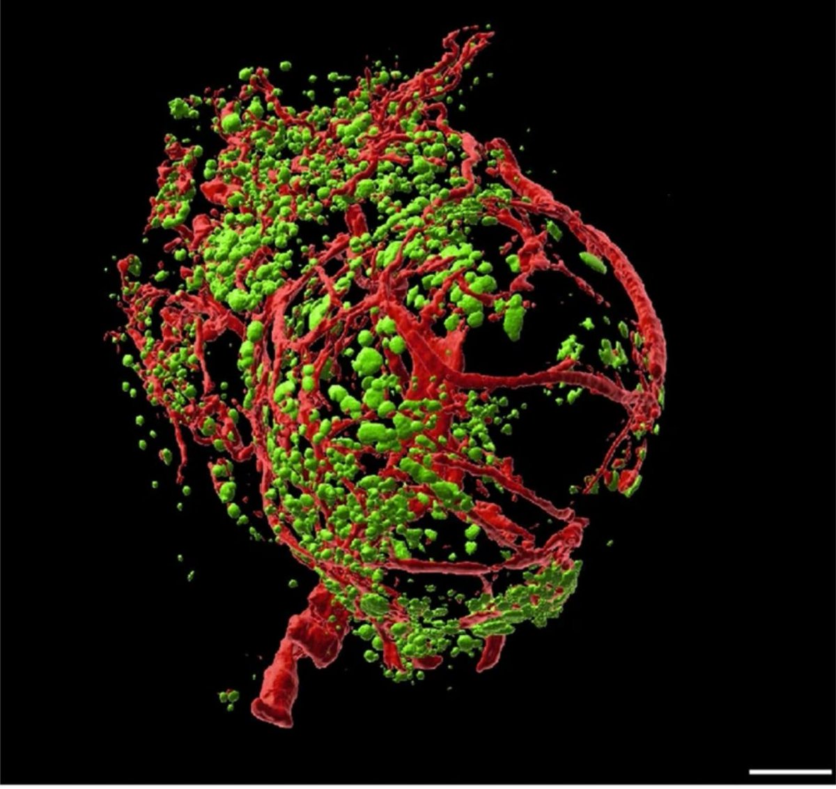 UmeaFor's tweet photo. UCMM would like to congratulate Prof. Ulf Ahlgren’s group on their excellent new paper (Mesoscopic 3D imaging of pancreatic cancer and Langerhans islets based on tissue autofluorescence) published recently in Scientific Reports (https://t.co/YyZHcGixx1). Image: IPMN cyst. https://t.co/Xqm5HCD7XN