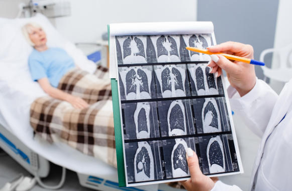 ICYMI: NH recently ranked 3rd nationally in high-risk lung cancer screening rates! This is great news to us at <a href="/SolutioNHlth/">SolutionHealth</a>. Both <a href="/ElliotHealthSys/">Elliot Health System</a> and <a href="/SNHHealth/">Southern NH Health</a> are committed to offering lung screenings. Congratulations to everyone who helped improve NH's lung-screening rates!