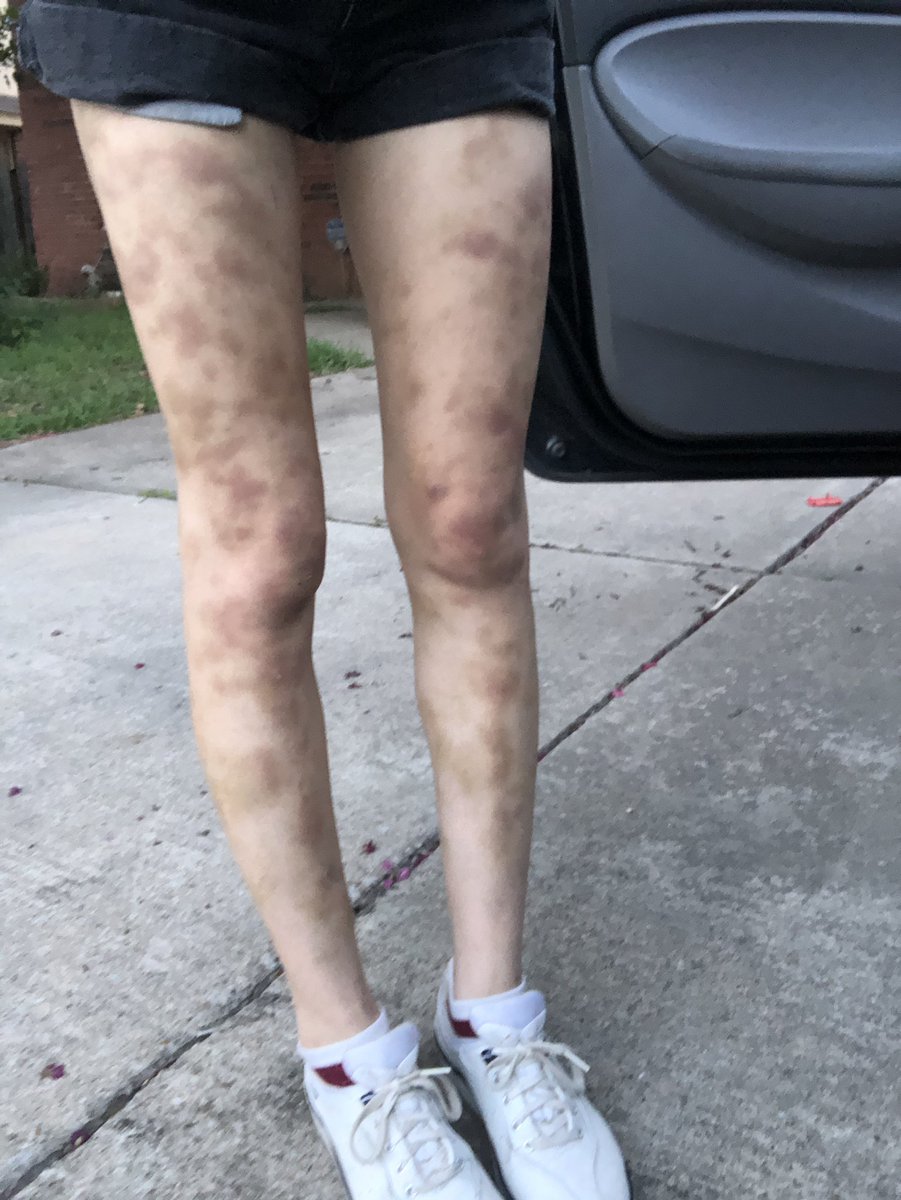 mostlykayla's tweet photo. Now that I have a new job, I’m exposing UPS. LMAOOOO I WAS 90 LBS AND 5 FT lifting 100LB+ EVERY DAY. FOR WHY. FOR WHY. https://t.co/SzXvgd5hDe