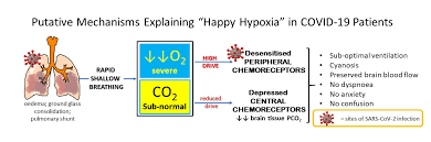 Se le llama "hipoxia feliz" y retrasa la búsqueda de ayuda médica. Es indispensable tener oxímetro en casa y detectar cuando baja oxigenación. Si es menor de 92% o baja más de 4% la saturación habitual, es momento de conseguir oxígeno en casa o acudir urgente a un hospital.