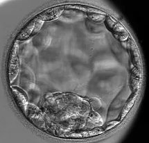 Are you an embryologist? Do you work in an IVF clinic that offers add-ons? The VALUE study would love to hear from you! We want to know more about the use of add-ons in UK clinics. Get involved here  valuestudy.org #fertility #research