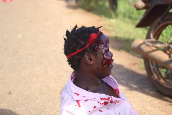 Erickibalama_'s tweet photo. NB. SCARY PICTURES 
#Kayunga
Police and security operatives keep shooting Ugandans
😭😭😭😭😭 https://t.co/TnXDPzxDnK