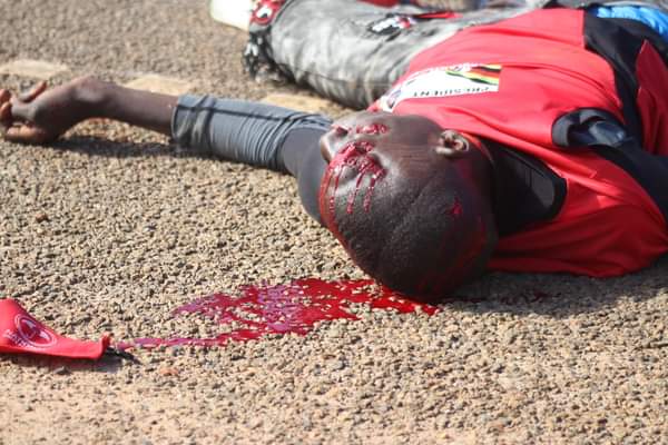 Erickibalama_'s tweet photo. NB. SCARY PICTURES 
#Kayunga
Police and security operatives keep shooting Ugandans
😭😭😭😭😭 https://t.co/TnXDPzxDnK
