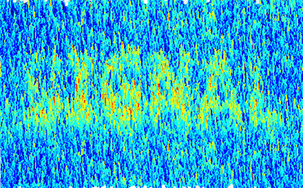 Exercising Fontan patients is a fantastic way to improve signal-to-noise ratio since low-flow will result in larger measurement error, especially in the systemic venous circulation. 4/8