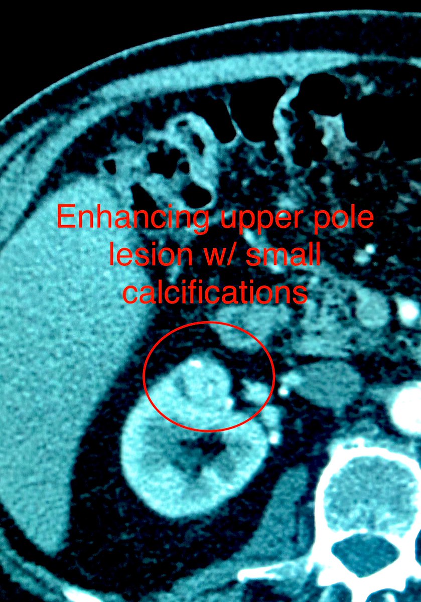 zachary masi tweet media