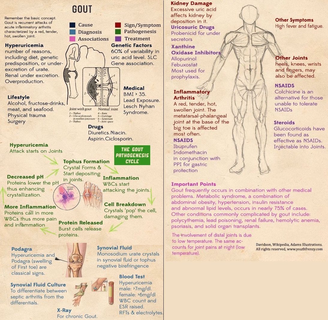 ManualOMedicine's tweet photo. Gout Summary . #meded #foamed #usmle #medtwitter https://t.co/Gcw7ZHblw2