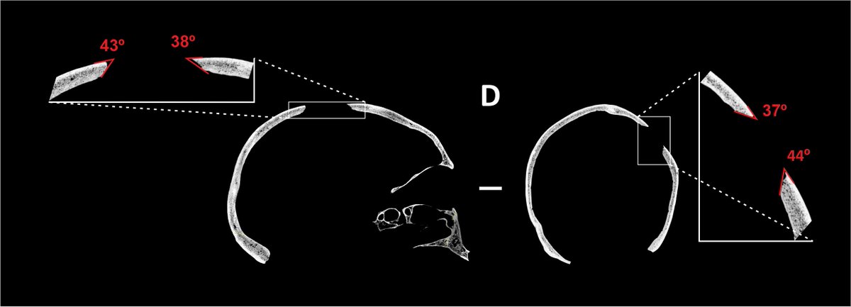 In addition, if we look at the crossed sections of the skull, obtained through  #microCT scan, we see acute angles. This, together with the previous characteristics, tells us that the bone was green at the time of breakage, that is, it is a  #PerimortemTrauma.