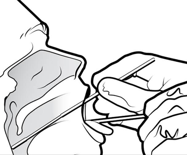 Подготовка к мазку на ковид. Мазок на ковид. Мазок из носа на коронавирус. Подготовка к мазку на ковид. Взятие мазка на коронавирус.