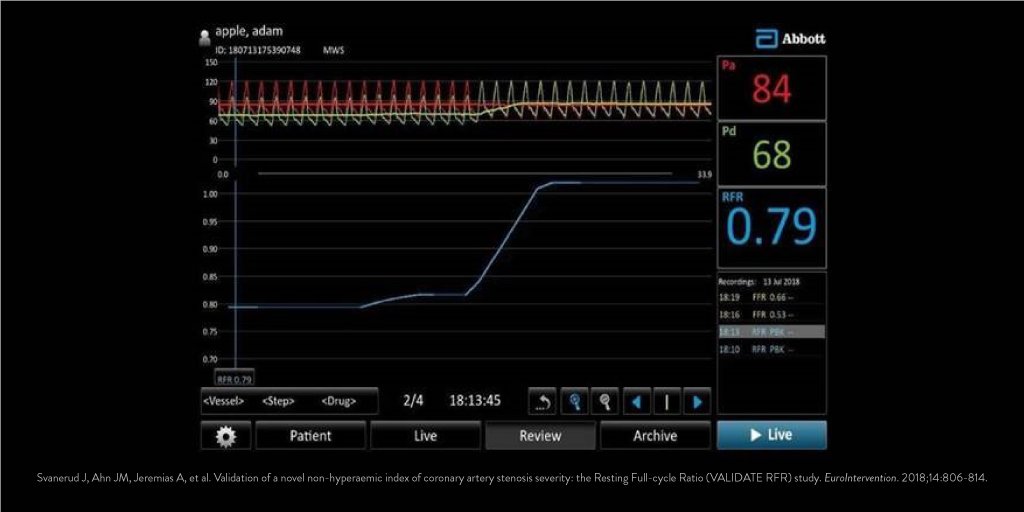 Abbott Cardiovascular on Twitter:
