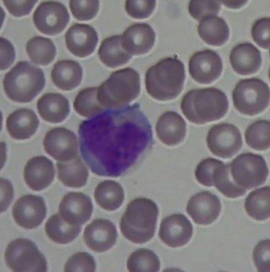 We scan with our heart 🔬🔬#mantiscope #hematology #pathology <a href="/mantiscope/">Mantiscope</a>