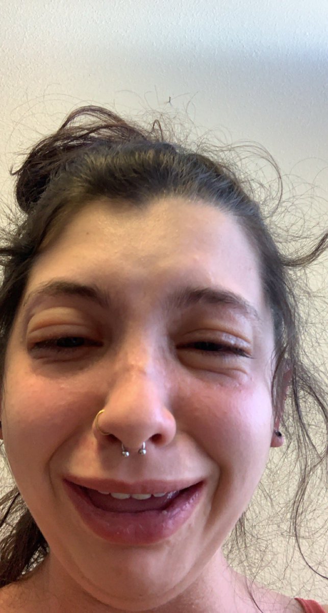 allergy testing went great turns out im allergic to "all of the above"