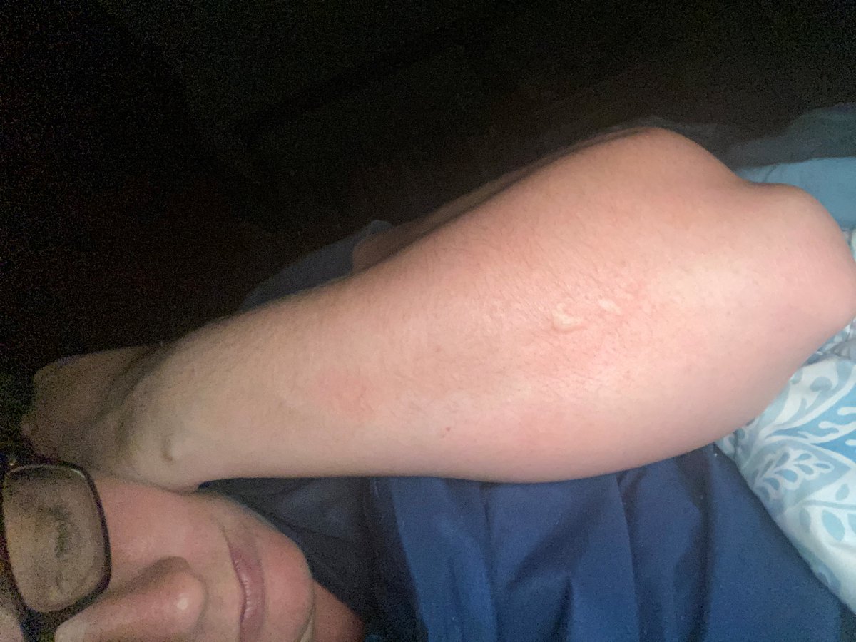 Doctors don't know much about post-COVID-19 syndrome. They say once a vaccine is available, they'll be able to study persisting symptoms. Although they're miserable now, both Jennifer and Kari are hopeful science will catch up and help other COVID-19 victims in the future.