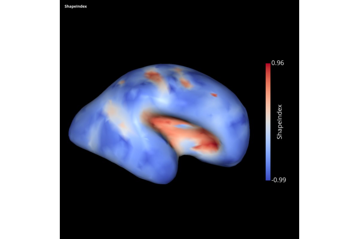 brainhackorg's tweet photo. Project.9. Development of the SLAM -Surface anaLysis And Modeling- python package by Guillaume Auzias & @AlexandrePron
https://t.co/V0nubR2jNI @BrainhackM #brainhackMarseille2020 #brainhackglobal2020 ππ§ π¨πΏβπ»π©πΌβπ¬ https://t.co/7jUzI3Xzdl