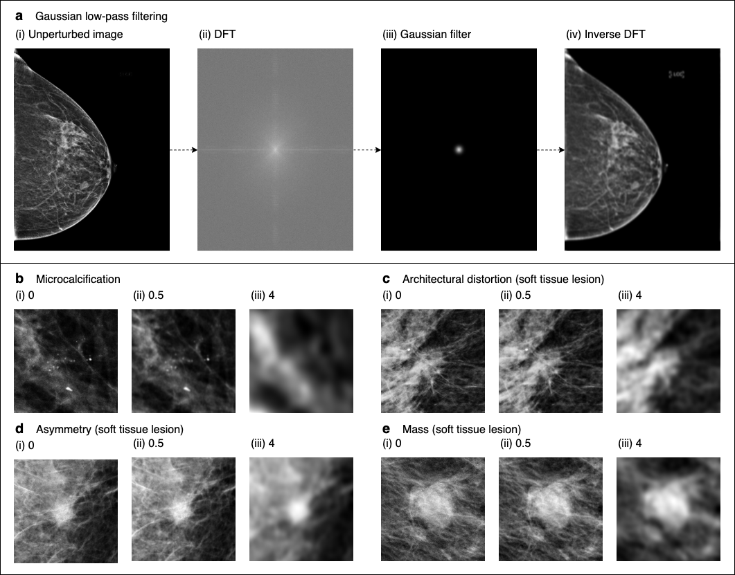 In our breast cancer screening case study, we compare radiologists and DNNs with respect to their robustness to low-pass filtering (blurring), drawing separate conclusions for microcalcifications and soft tissue lesions.3/9
