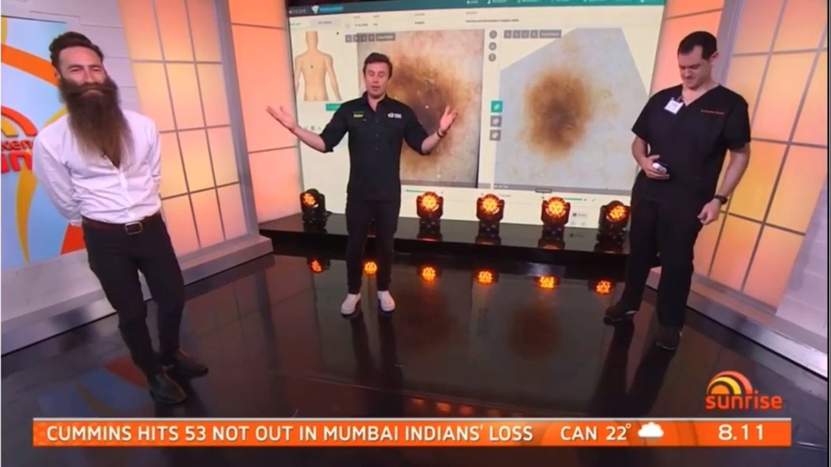 MoleScope's tweet image. Things are heating up in Australia! Beard Season speaks with the Sunrise 7 news team about the importance of skin checks year round! More info and skin tips at bit.ly/33tx0II