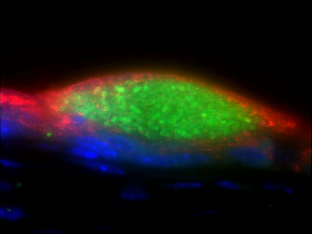 We did several screens, but the big one took advantage of the ability to use clinical strains. We studied how uropathogenic E. coli makes large bacterial collections inside bladder epithelial cells - a key contributor to our inability to cure recurrent UTI with antibiotics. 11/14