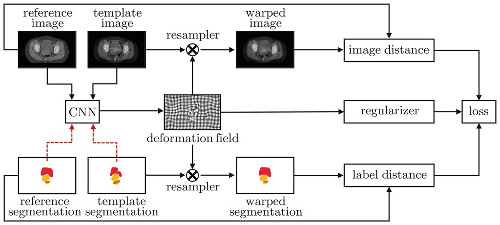 FraunhoferMEVIS's tweet photo. Improving deformable image registration by structure guidance constraints: find out more in our presentation today at 15:40 UTC at #WBIR2020. https://t.co/v1X5iJqtlp
@wbir2020 #DeepLearning #AI #ImageRegistration #ConeBeamCT https://t.co/JbHLs3ITkO