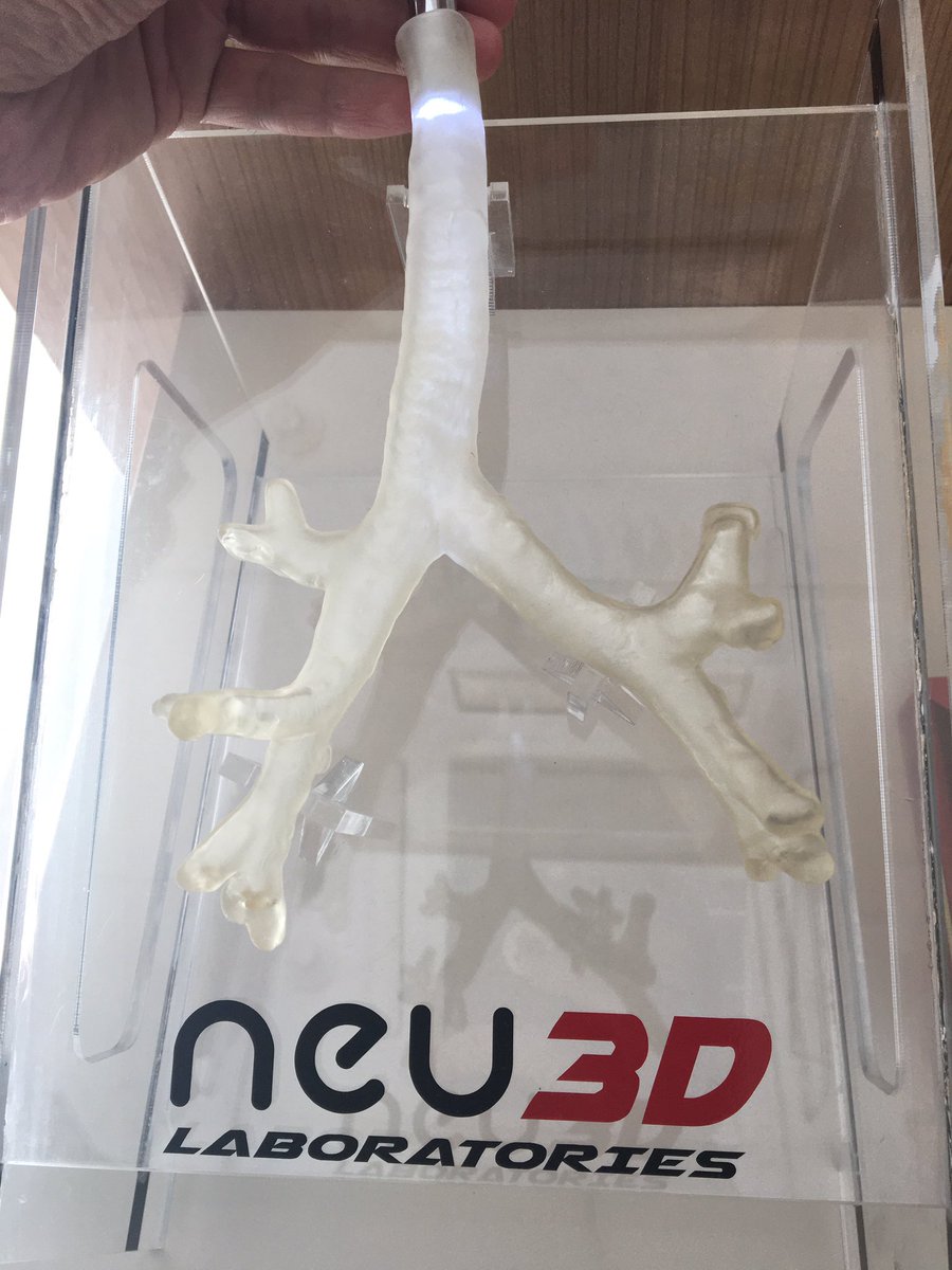 #3dprinted flexible bronchoscopy simulator. Modeled from CT scan. Printed at <a href="/Prusa3D/">Prusa3D</a> SL1 with transparent resin. #3Dprinting #AdditiveManufacturing