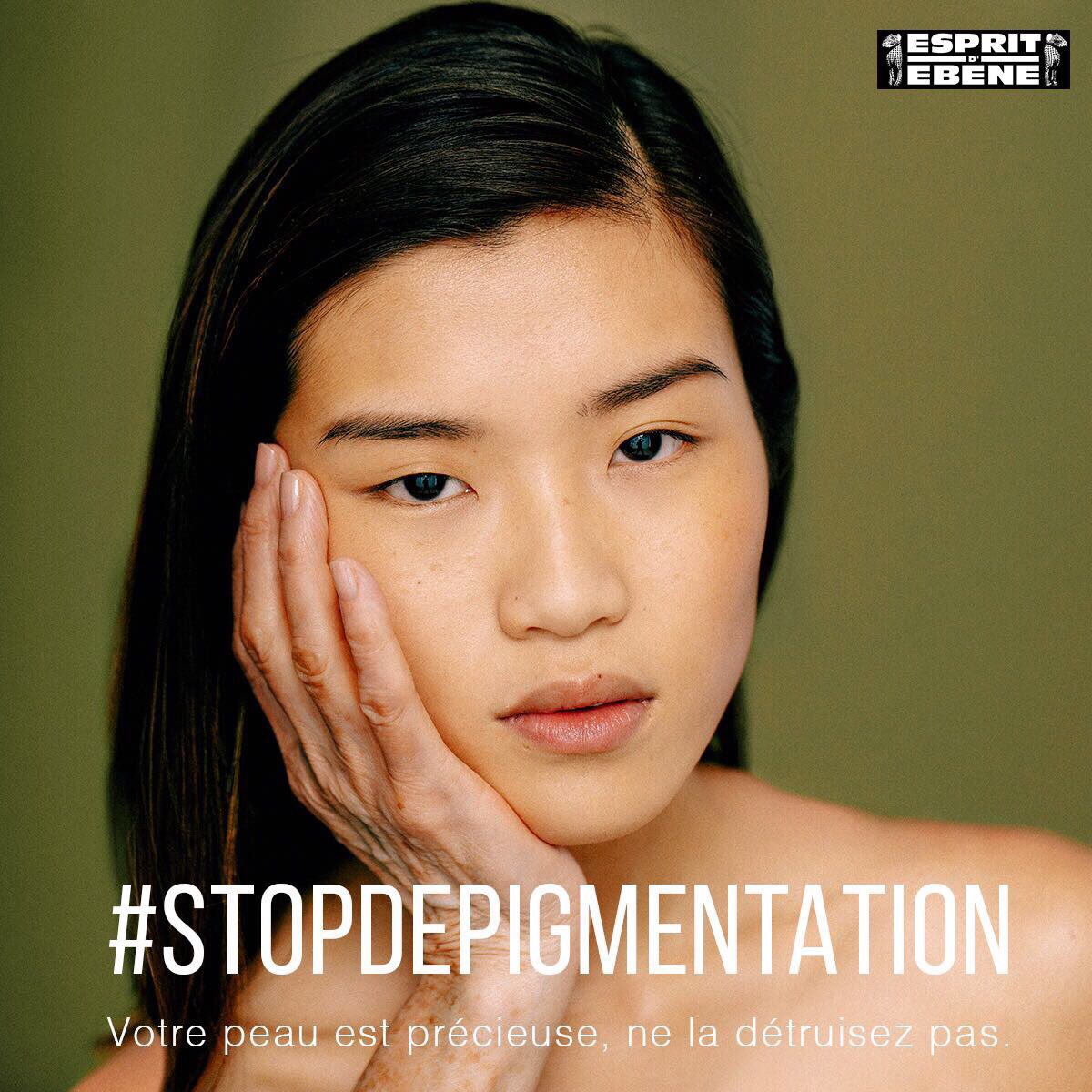 bvmakosoldat's tweet image. Votre peau est précieuse, ne la détruisez pas 🙏🏾 #StopDepigmentation #StopAuColorisme