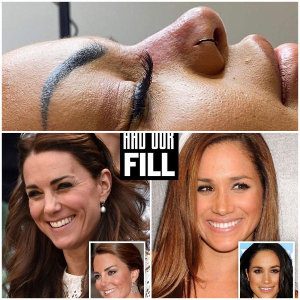 GoddessAesthet1's tweet photo. Kate ‘reverses-ageing’ and Meghan’s ‘#nonsurgicalnosejob have sparked #filler craze
💃Reverse the signs of #ageing 
🔥Define your #Lips #Nose #jawline cheeks and much more 🙌
💟Book in with Joanna 07774600700 visit our site 👇🏼
https://t.co/kRRSz0n7Ie
@SevenoaksMums @STFCLadies https://t.co/0aWzP6hMzY