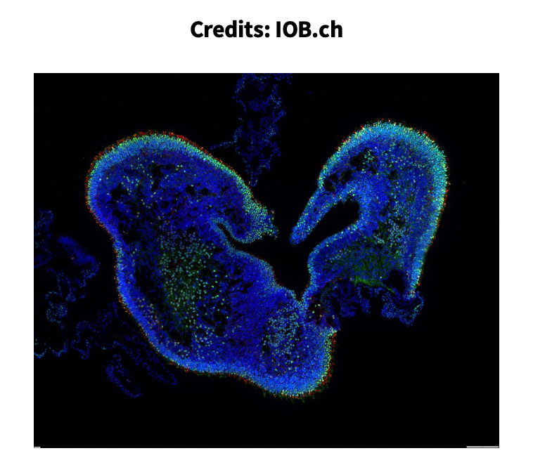 mxwbio's tweet photo. Our featured #Retinal #Organoids must-read article is written by @CameronSCowan1, @Organoidlab_IOB et al. from @IOB_ch and @NovartisScience. They developed light-sensitive human retinal organoids with functional #synapses. 
Find the article here: https://t.co/9eNIbM57b9 #MxWReads https://t.co/n3olMcpE3Q