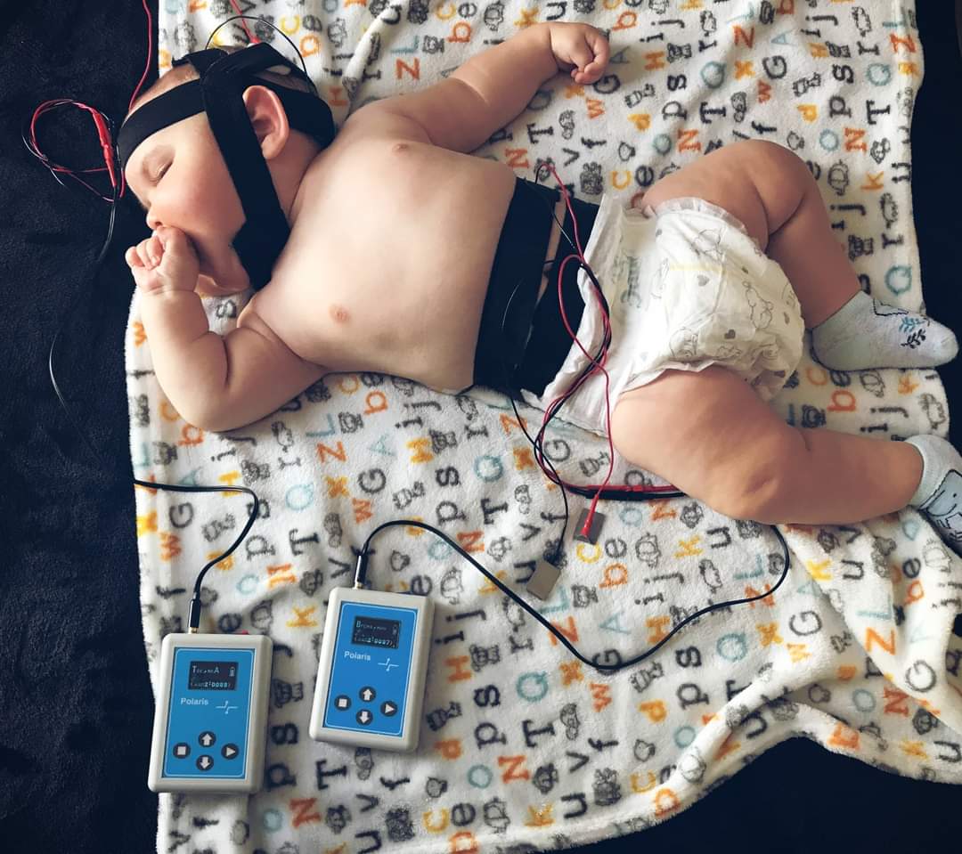 Аппарат микрополяризации Polaris применяется на взрослых и детях. #tdcs #micropolarisation #ткмп #микрополяризация 
dxcomplex.com.ua/terapevtichesk…