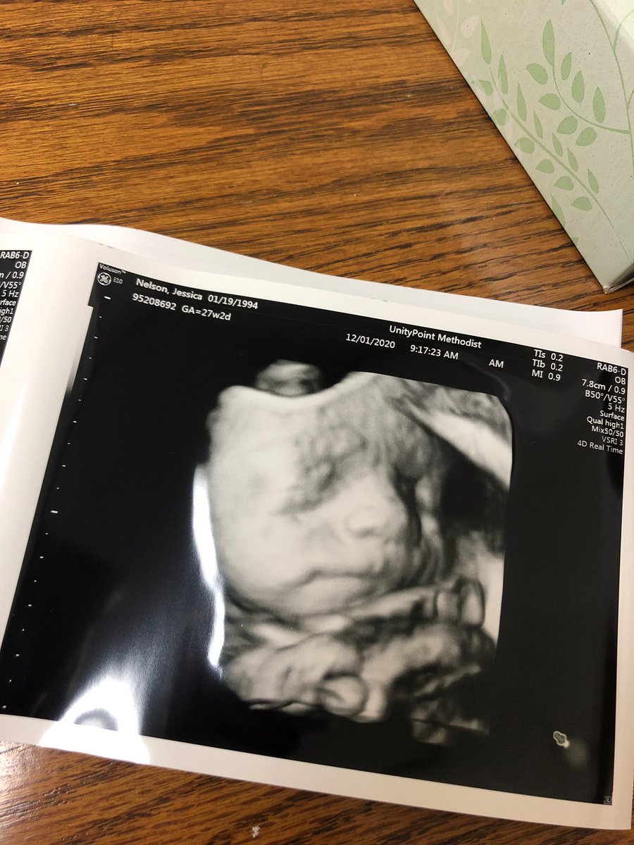 jnellz23's tweet photo. He weighs 2lbs 1oz, is 27 weeks old, and obviously still needs to work on his biceps 💪🏻 This is the first time it feels like we’re really getting to know him, and we think he’s the absolute best 🙌🏻 https://t.co/USGz2fBk43