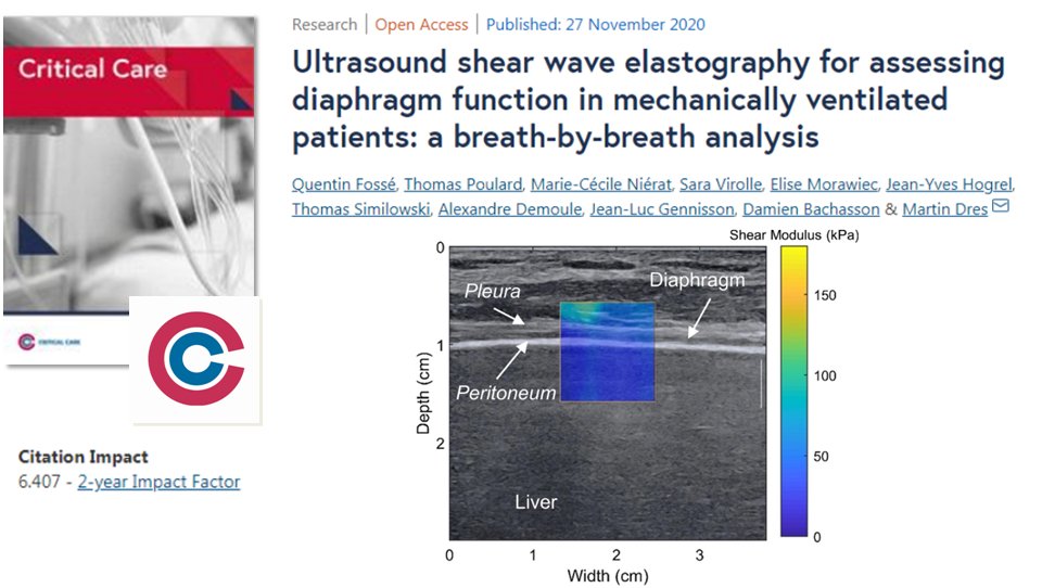 #CritCare #OpenAccess 
#Breath-by-breath: #ultrasound #elastography for assessing #diaphragm function bit.ly/3qooJ2j

#FOAMed #FOAMcc #BMC #ICU #respiratory #mechanical_ventilation <a href="/jlvincen/">Jean-Louis Vincent</a> <a href="/ISICEM/">ISICEM</a>