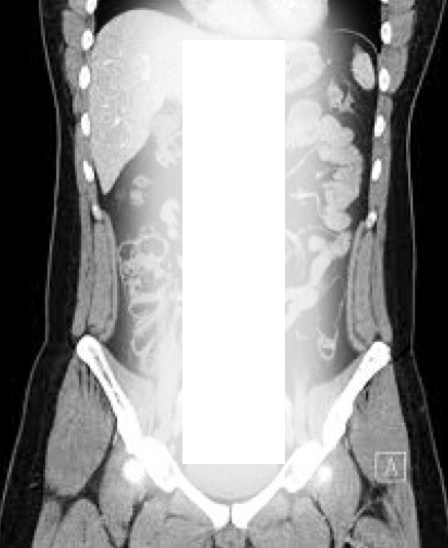 I can't believe it, I found another monolith