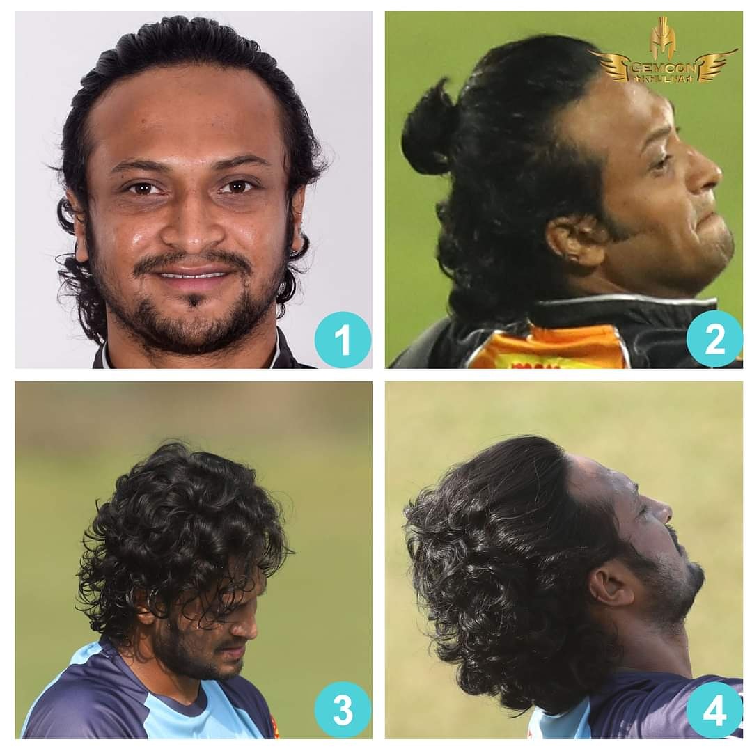Khulna Titans (@khulnatitans) on Twitter photo Which style you like better <a href="/Sah75official/">Shakib Al Hasan</a> 🤷♂️
1️⃣ Band it
2️⃣ Ponytail
3️⃣ After shower look
4️⃣ Back combing/brush
#GemconKhulna 💇♂️ Which style you like better <a href="/Sah75official/">Shakib Al Hasan</a> 🤷♂️
1️⃣ Band it
2️⃣ Ponytail
3️⃣ After shower look
4️⃣ Back combing/brush
#GemconKhulna 💇♂️
