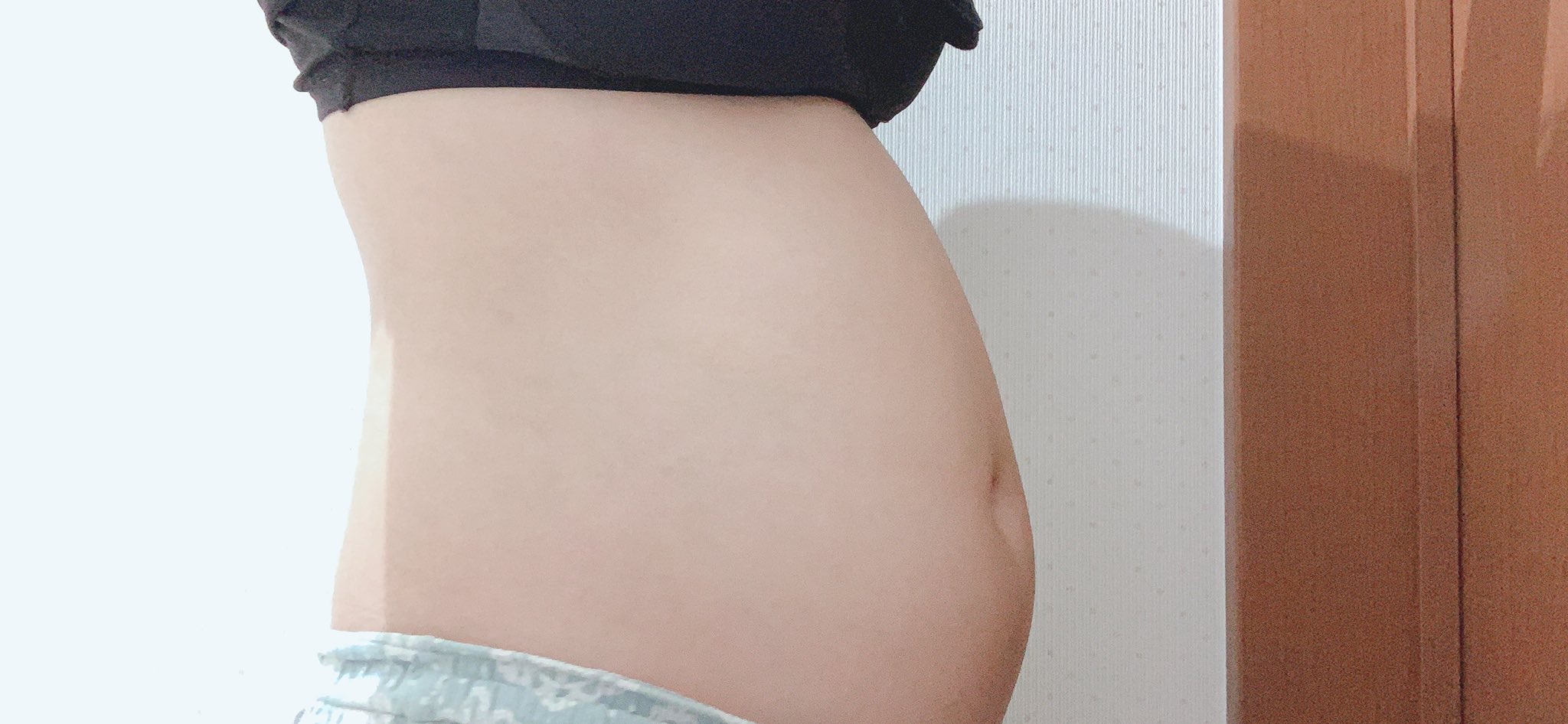 胃下垂様♡専用 PDNショップ / PEG胃ろう（胃瘻）用腹帯 「Ztai」