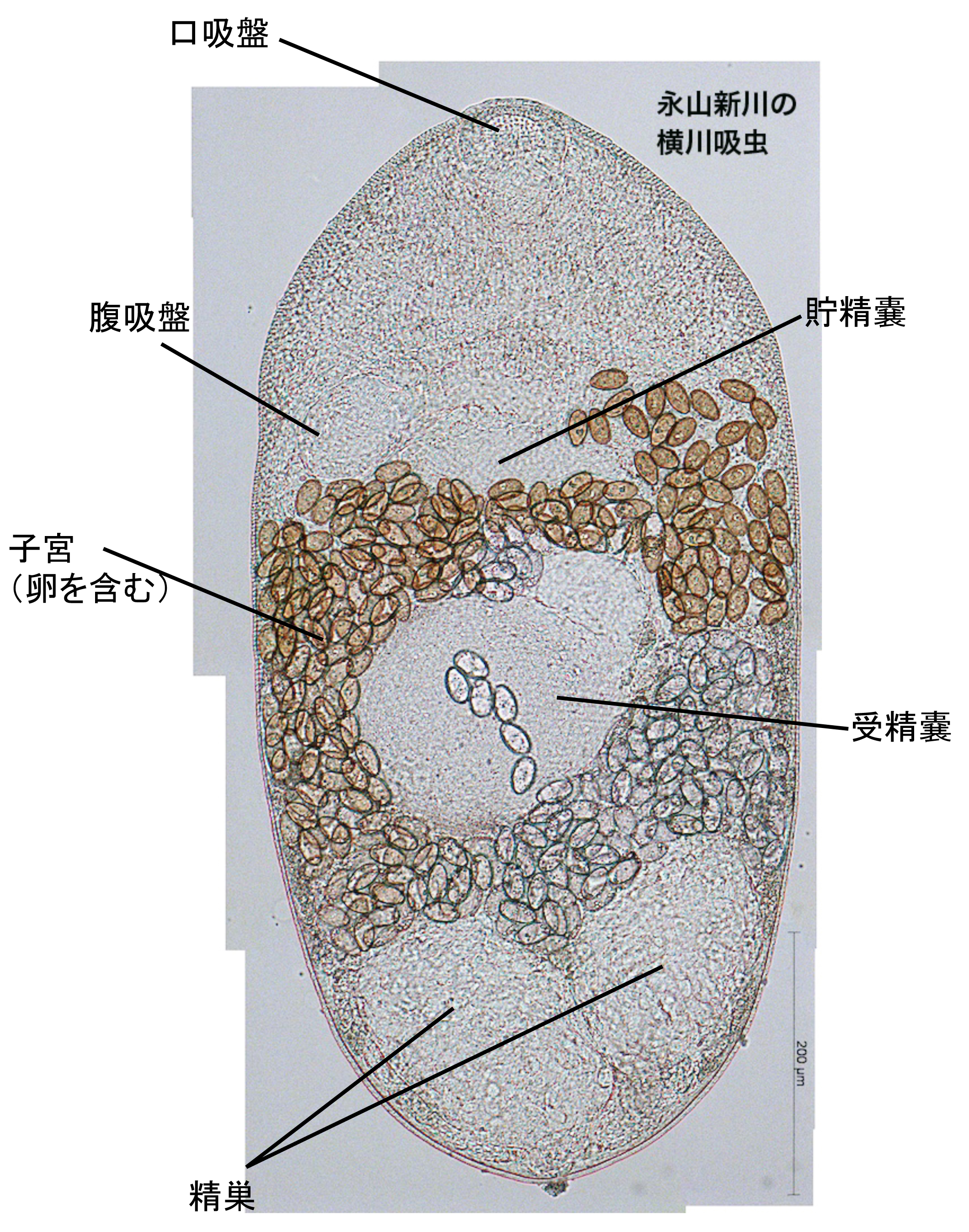旭川医大寄生虫学講座 これがかの有名な横川吸虫の成虫だよ 吸虫は一般的に雌雄同体だよ たくさん入ってるゴマみたいのが虫卵 なんだ 終宿主の便に含まれる卵がカワニナに取り込まれ カワニナから出て魚のウロコにくっつき 哺乳類や鳥類に食べられて成虫